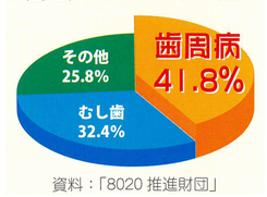 抜歯原因グラフ