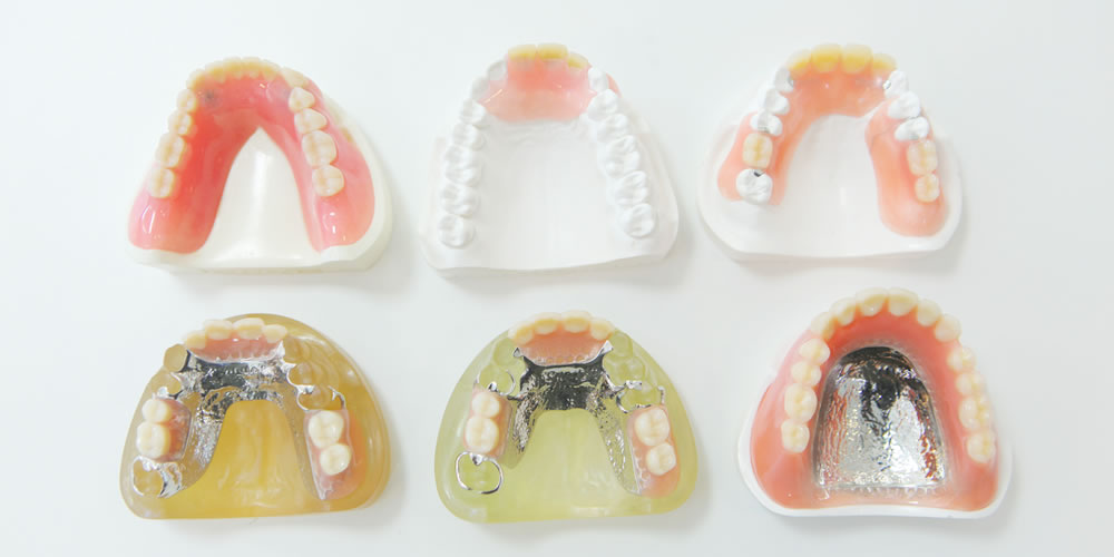 保険の入れ歯と自費の入れ歯の違い