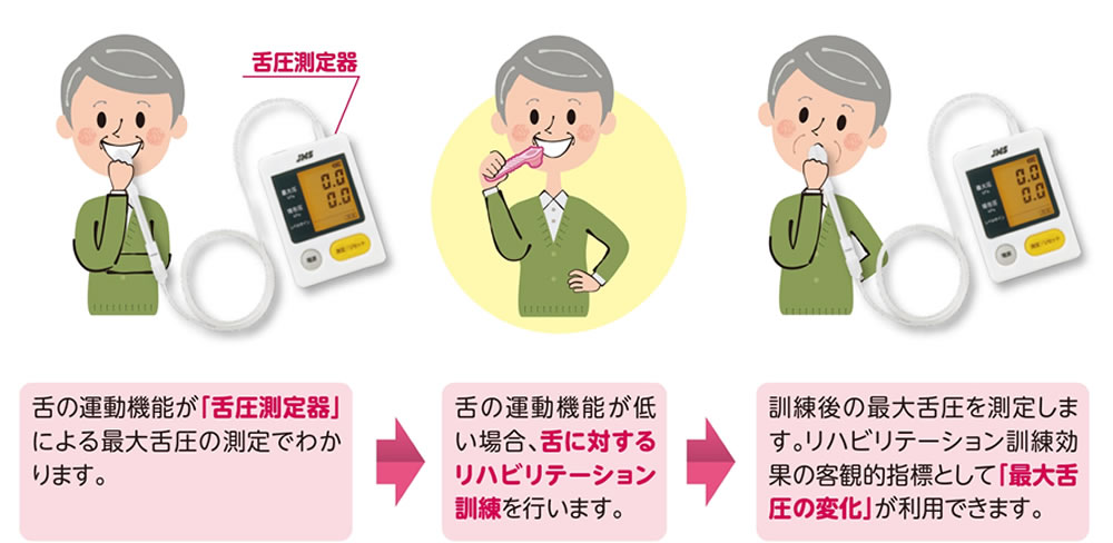 舌圧検査について