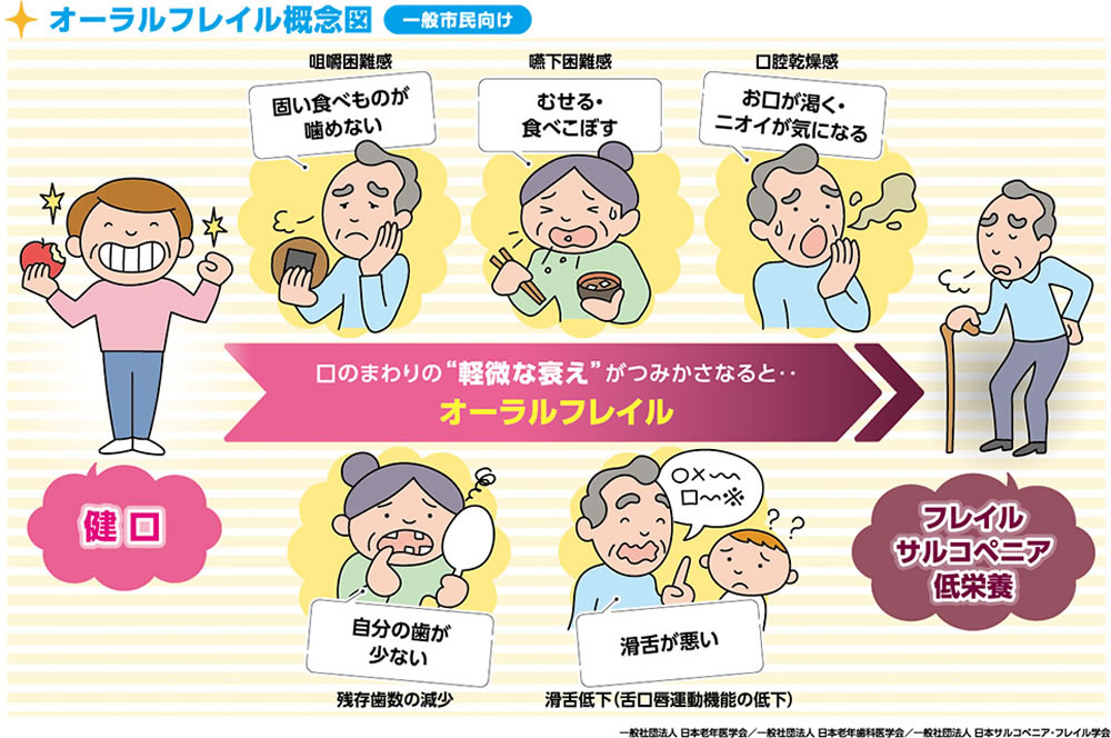 口腔機能低下症とオーラルフレイルの関係